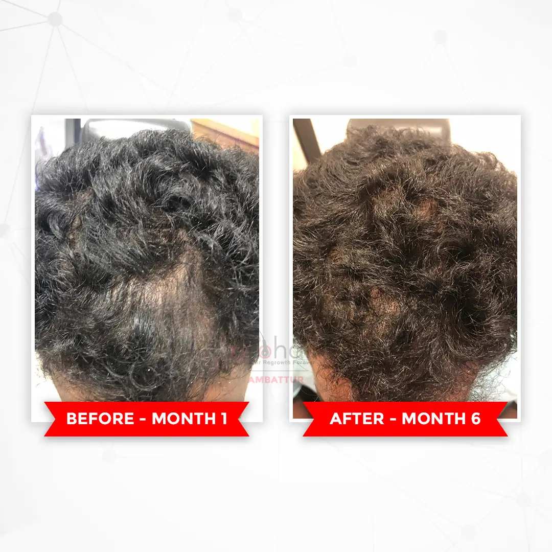 Hair treatment client - Client - Month 1